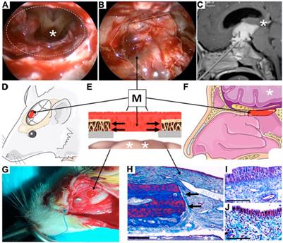 Endonasal CNS Delivery System for Blood-Brain Barrier Impermeant Therapeutic Oligonucleotides Using Heterotopic Mucosal Engrafting